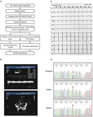 Identification of a novel variant in N-cadherin associated with dilated cardiomyopathy